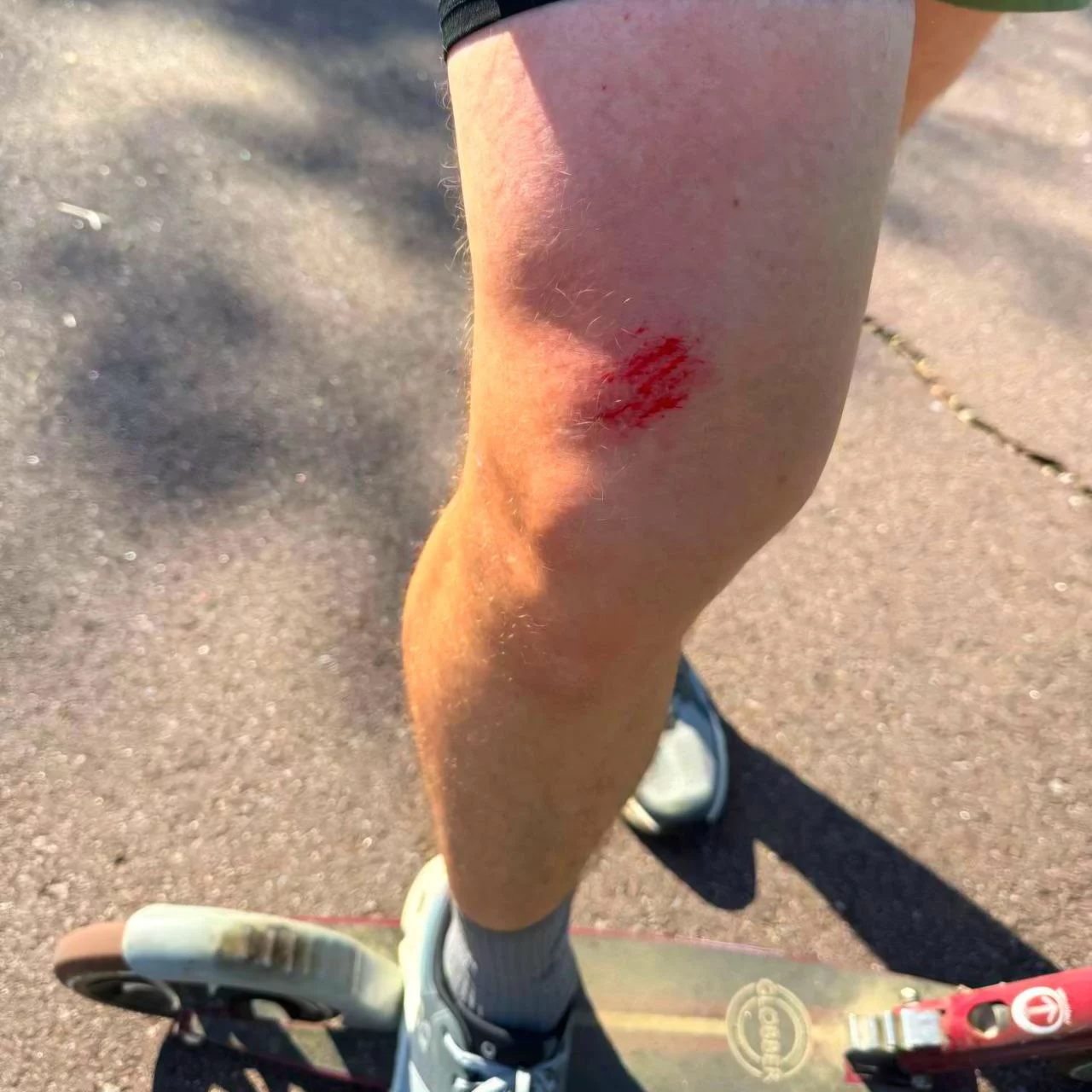 The price of perseverance